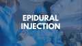 What is an Epidural Injection?